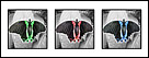 This is a digital set of three photos of a butterfly, the background is black & white, and and foreground butterfly has an accent color.